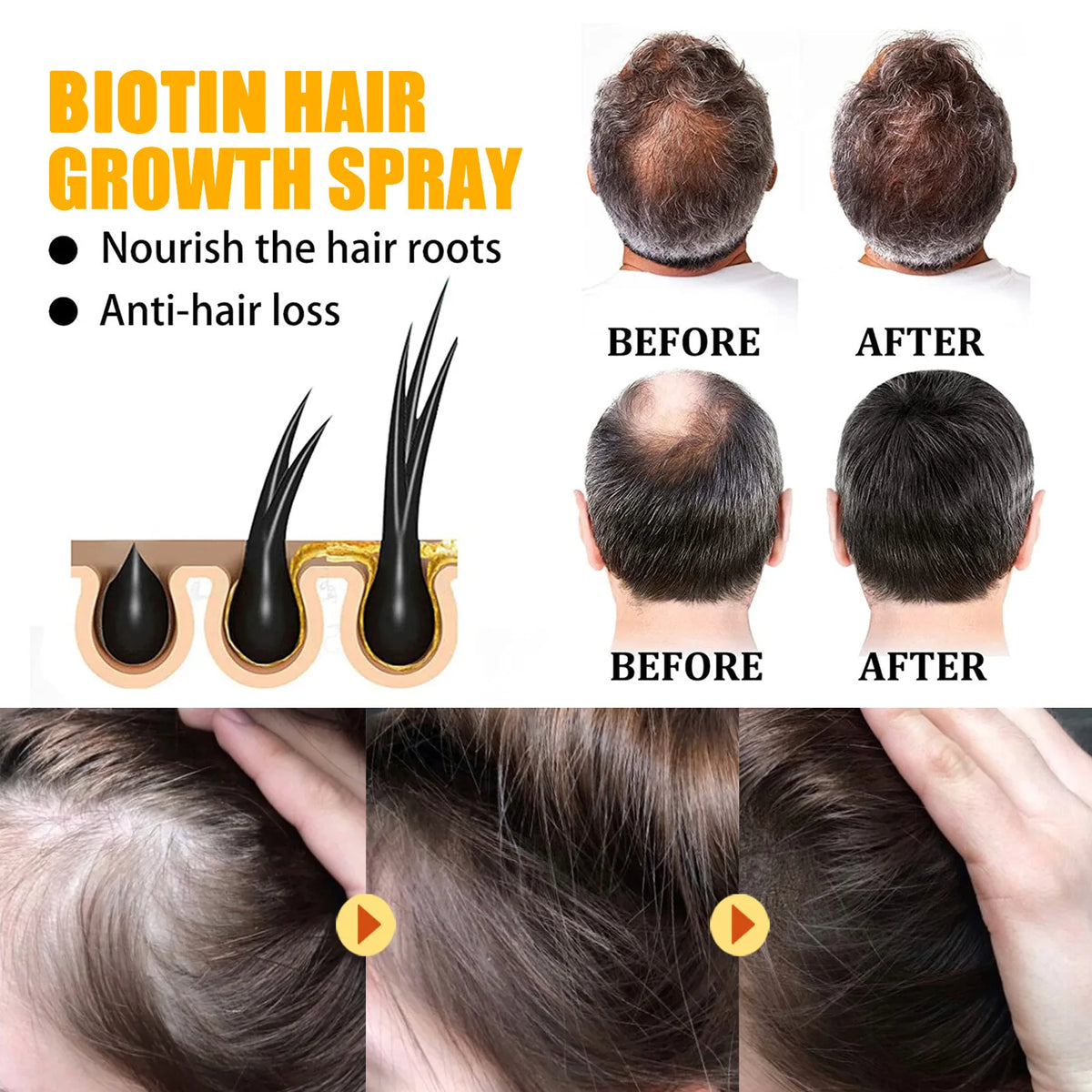 Biotin Hair Care Spray Nourish Scalp Hair Follicle Reduce Hair Loss Stabiliz Hair Root Refresh Oil Control Natural Plant Essence