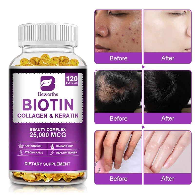 BEWORTHS Collagen and Biotin Capsules Biotin for Hair Growth Healthy Nails &amp;Skin Hair Farming Supplement Beauty Health Skin Care