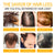 Biotin Hair Care Spray Nourish Scalp Hair Follicle Reduce Hair Loss Stabiliz Hair Root Refresh Oil Control Natural Plant Essence